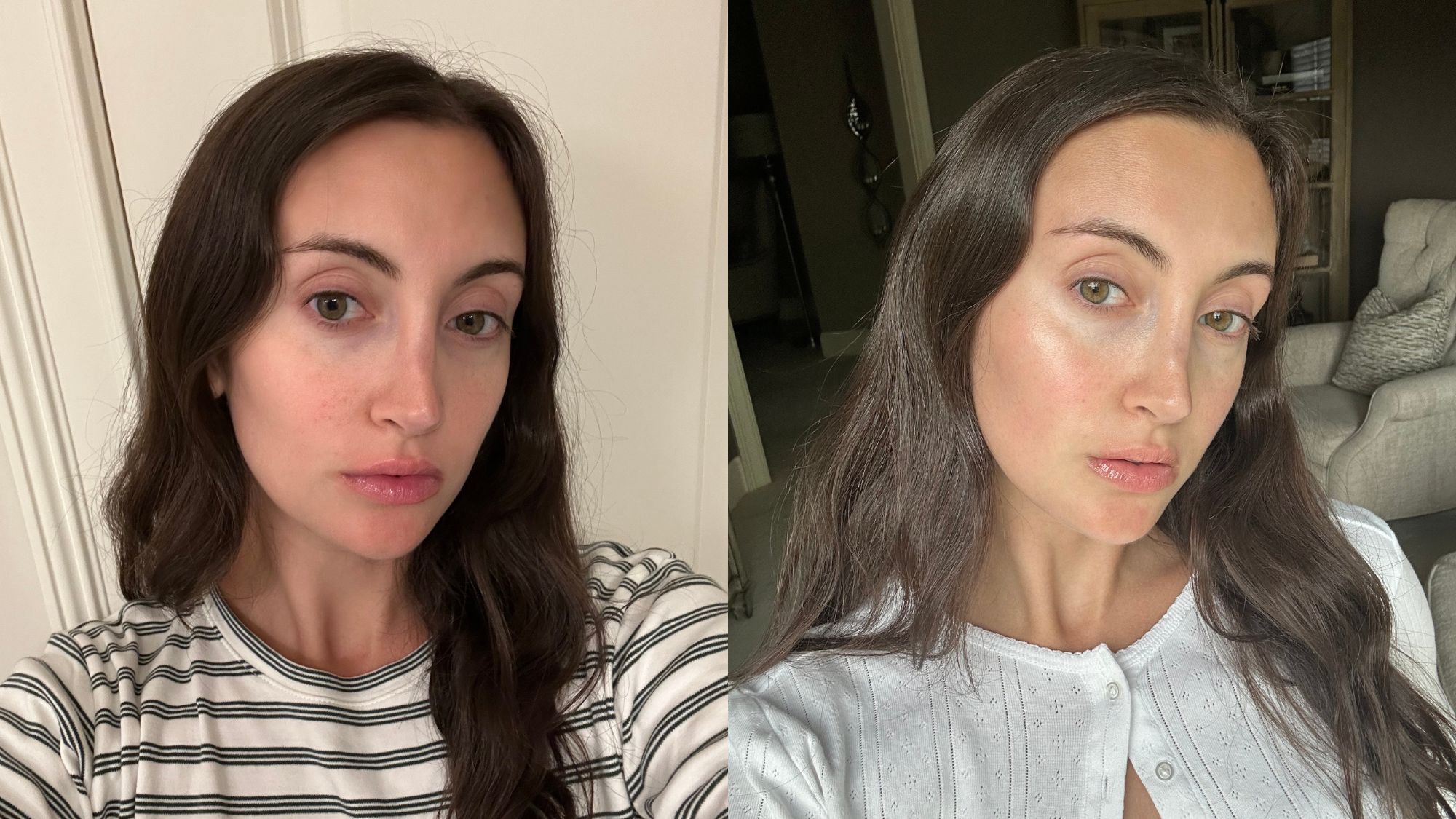 A split image of Alyssa on the first day of testing the PCA Skin Hydrating Toner, and after testing the toner for 7 days.